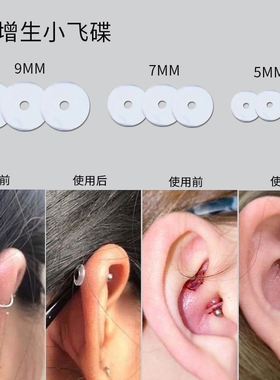 防增生食品级硅胶|379人收藏