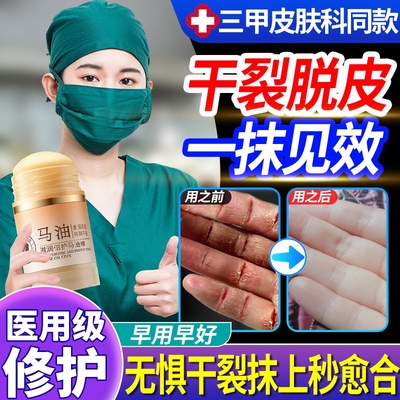 马油膏脚后跟干裂修复霜防裂保湿补水护手霜林足脱皮皴裂滋润凡士