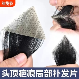 男士假刘海片鬓角补发假发片男女全真人发m型前额发际线假发贴片