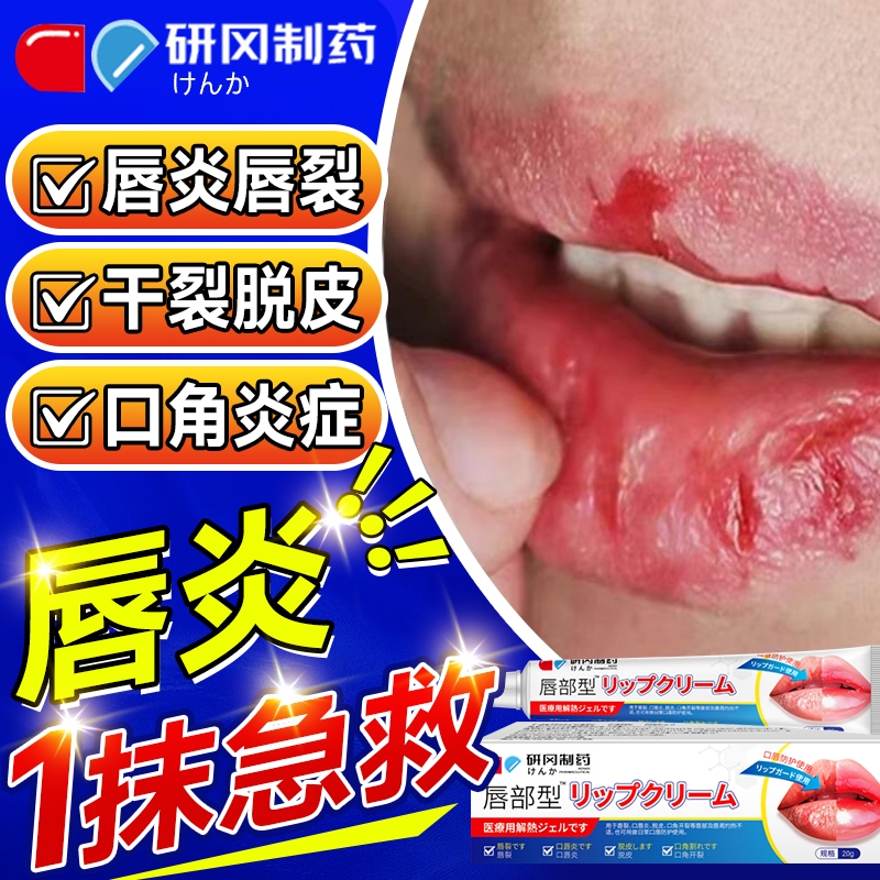 唇炎润唇膏嘴唇干裂脱皮专用保湿滋润去死皮口角炎疱疹修护医用型