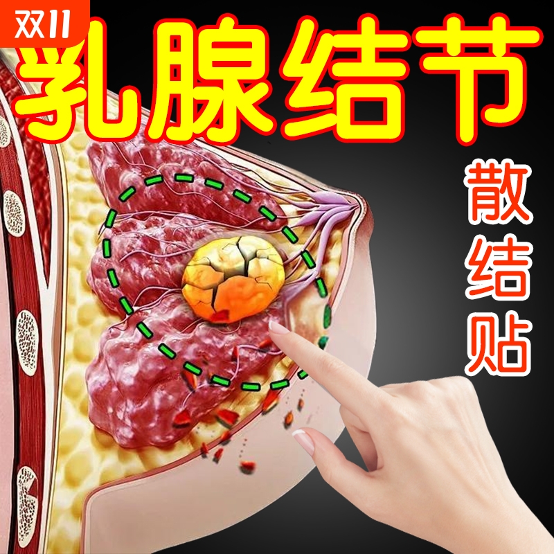 乳腺结节散结贴疏通硬块囊肿中药消乳房副乳胀痛炎溢液热敷理疗贴