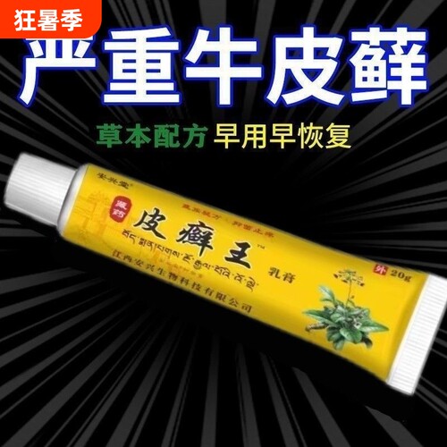 安兴堂藏药皮癣王乳膏20g皮肤外用抑菌软膏