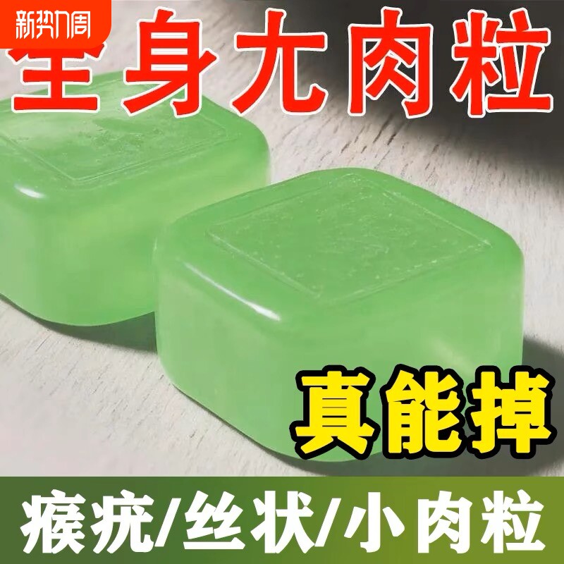 祛疣皂去小肉粒扁平瘊疣丝状手足洗脸护肤康尤皂男女通用国家草本