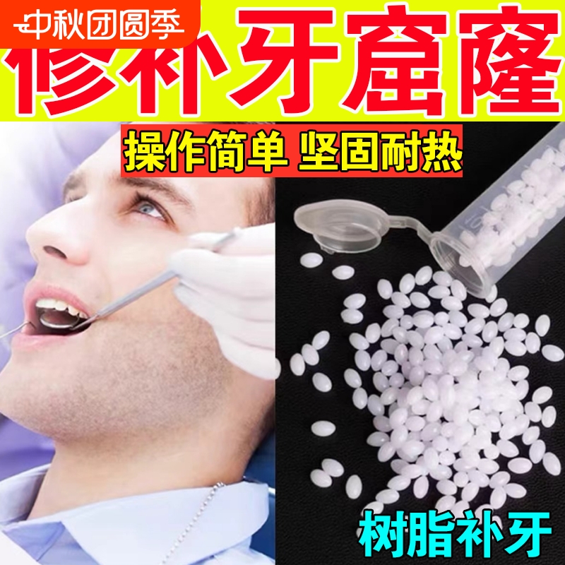 补牙神器树脂补牙膏|千人加购