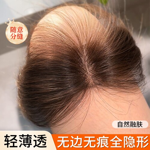 假发女片头顶真发增发量蓬松高颅顶轻薄无痕遮白发自然隐形补发片
