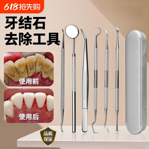 牙结石去除器牙齿清洁理口腔镜子牙去牙垢不锈钢牙齿护理工具家用