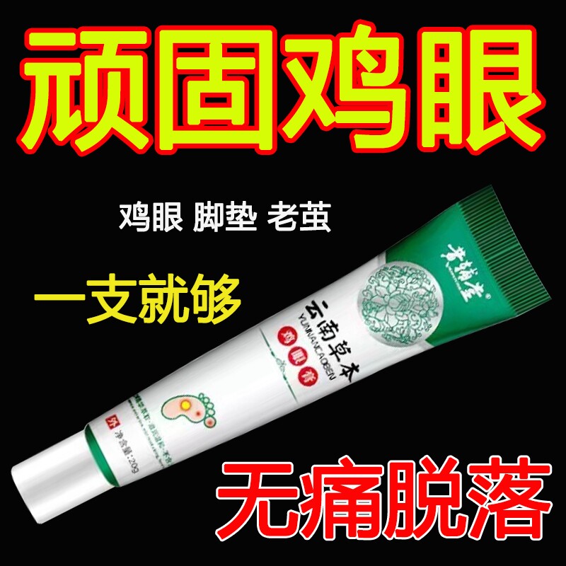 鸡眼膏鸡眼膏贴跖老祛茧肉刺脚趾鸡眼软膏官方正品鸡眼膏