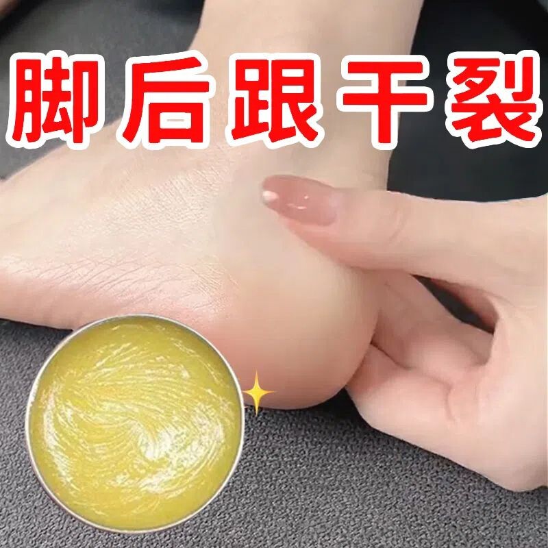 手足脚后跟干裂足霜手脱皮起皮滋润补水护手霜开裂干燥硬皮脚跟