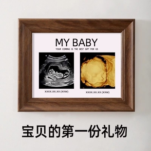 四维照片相框孕期胎儿nt B超彩超打印婴儿宝宝出生新生纪念照摆台