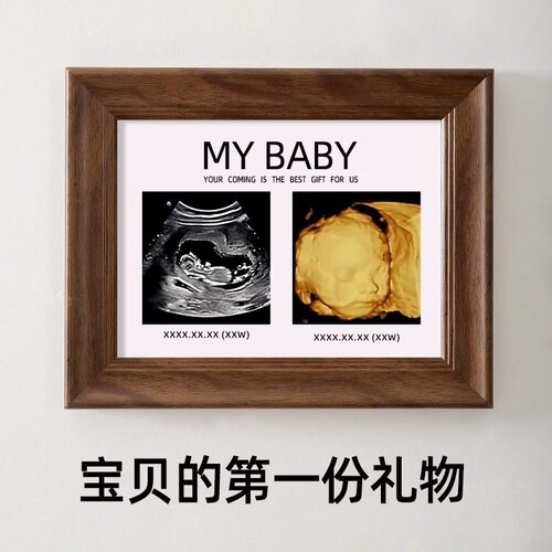 四维照片相框孕期胎儿ntB超彩超