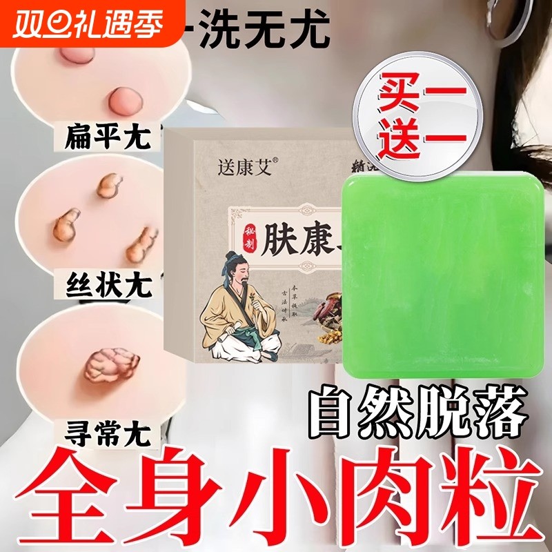 脖子上长祛去尤疣瘊小肉粒草本肤康皂专用克尤皂手工药香皂旗舰店