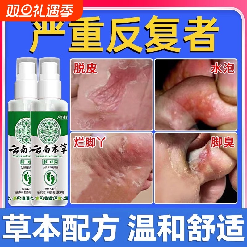 云南本草脚気喷雾止痒脱皮杀菌脚臭膏水泡烂脚丫真菌感染专用喷剂