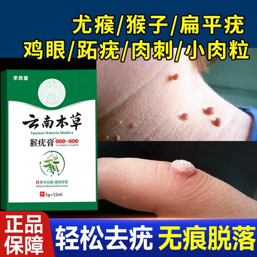 去除瘊疣扁平疣特效|千人加购