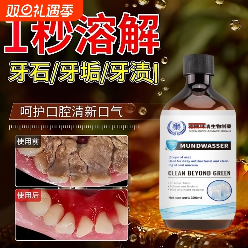 【爆款断货王】牙石溶解漱口水洗牙齿污垢牙垢黄牙渍清理神器正品