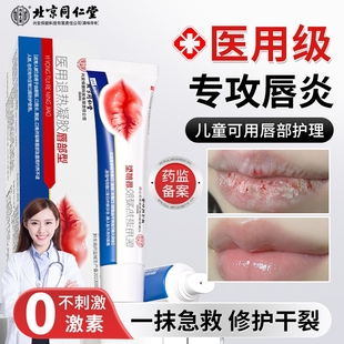 唇炎润唇膏嘴唇干裂脱皮唇膏保湿 滋润去死皮口角炎医用修护膏专用