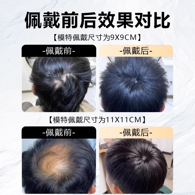 脱发后脑勺假发片头顶补发片男士发头旋发缝遮盖稀少女士模特真人