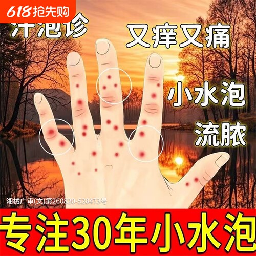 【胖东來爆款】汗疱疹热销第1名