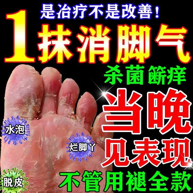 脚气特效脱皮杀菌真菌感染专用烂脚丫药脚臭脚趾止痒膏药L抑菌