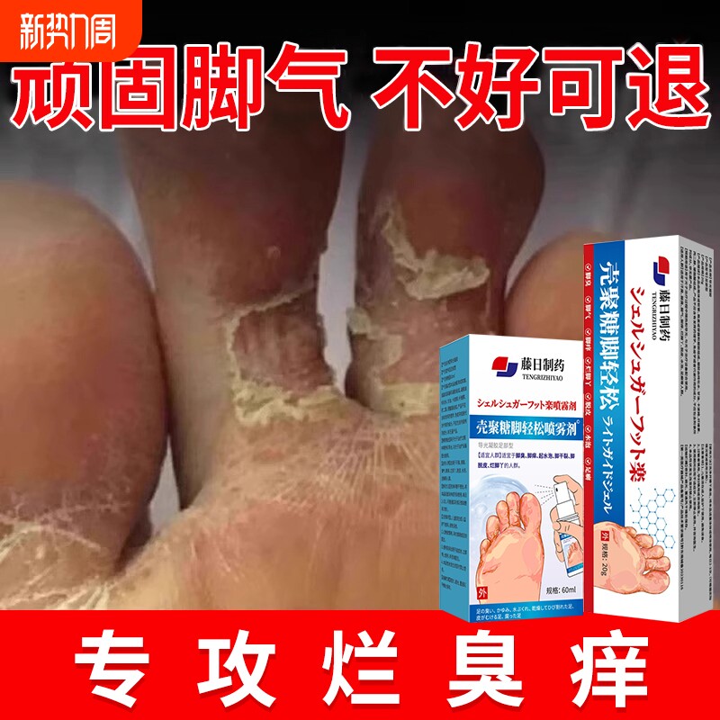 脚气痒皮杀菌喷雾去烂脚丫真抑菌感染糜烂除脚趾缝专用膏水泡修复