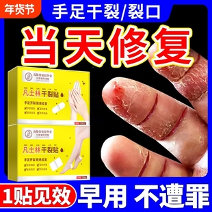 凡士林手足干裂贴手脚专用胶布护手指防水开裂口愈合皲裂卫仕正品
