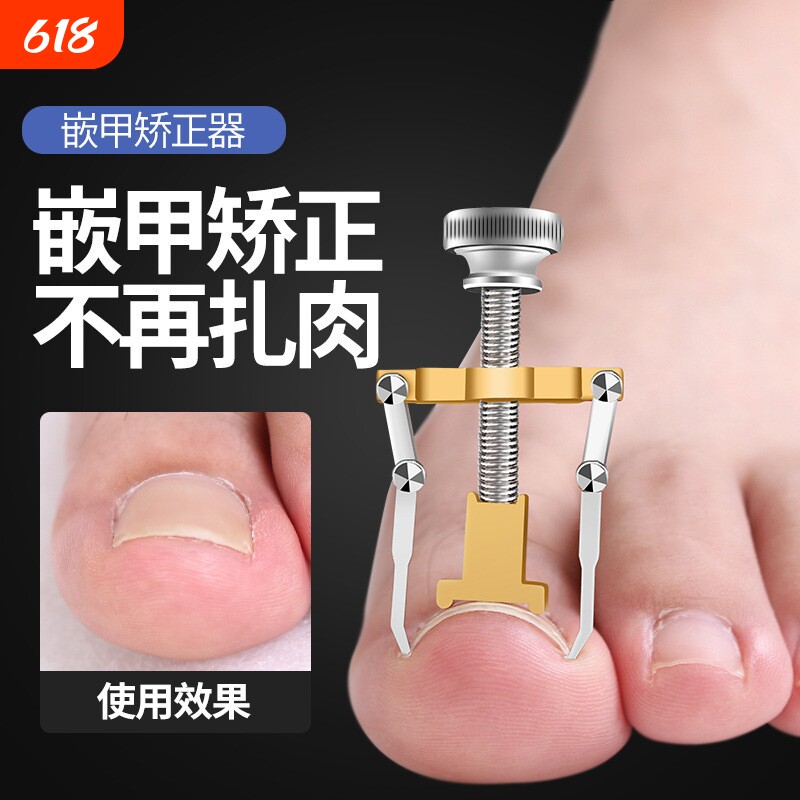 甲沟专用指甲嵌甲矫正器趾甲扎肉神器脚指甲往肉里长内嵌修正工具