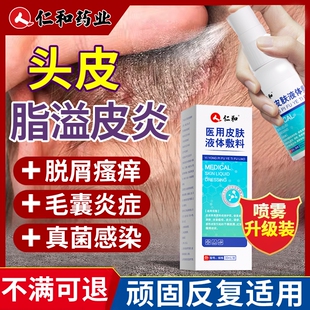 仁和脂溢性皮炎头皮毛囊喷雾剂头屑真菌感染头痒头皮癣抑菌专用