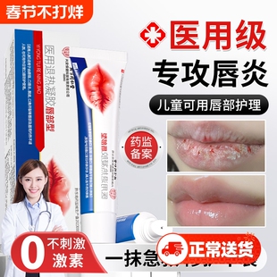 唇炎润唇膏嘴唇干裂脱皮唇膏保湿滋润去死皮口角炎医用修护膏专用