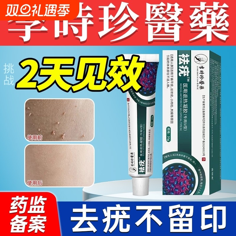 疣瘊肉粒一抹无忧疣体脱落药膏去尤扁平疣去疣一抹灵点疣软膏修复