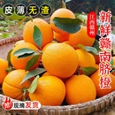 榨汁 包邮 江西赣南脐橙橙子新鲜赣州脐橙水果现摘手剥应季 甜橙整箱