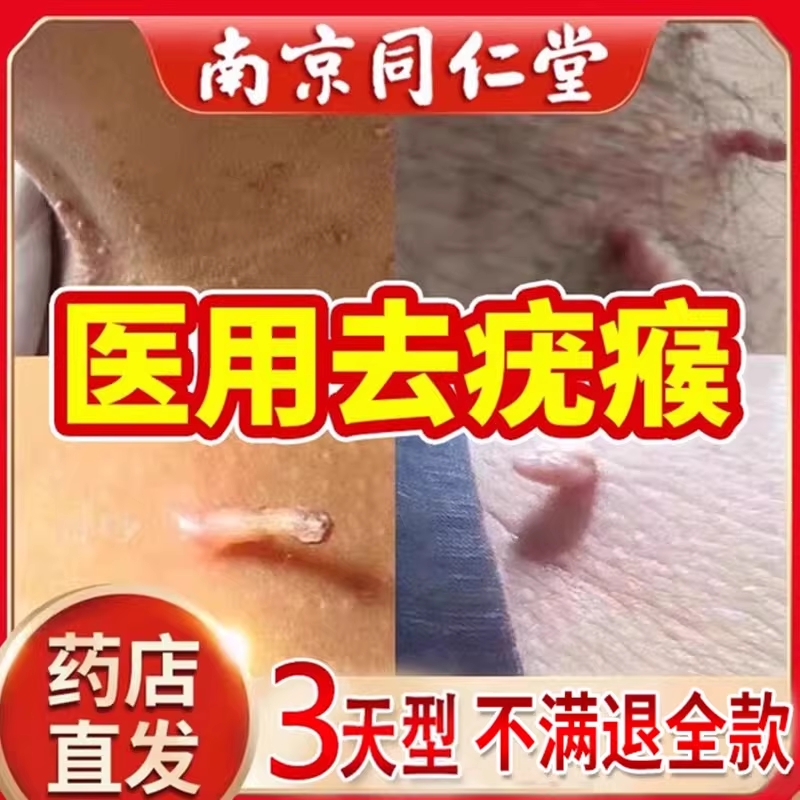 去疣瘊小肉粒神器药膏脖子上长疙瘩丝状瘊子扁平疣去除软膏一抹灵