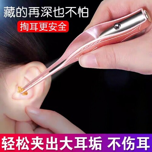 夹耳屎镊子挖耳朵神器发光掏耳镊子钳勺耳朵采耳工具儿童专用高清
