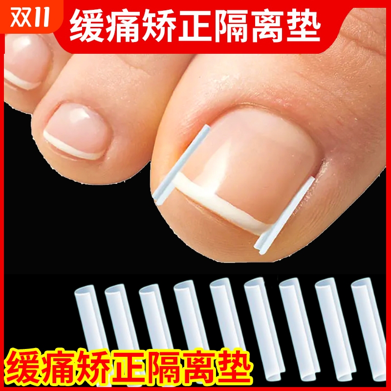 甲沟炎矫正神器指甲矫正器嵌甲专用隔离填充垫脚趾甲往肉里长纠正