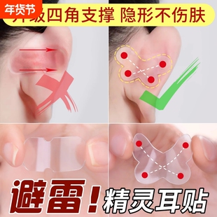 蝴蝶精灵耳贴强支撑女生隐形显脸小固定招风耳矫正器立耳定型神器
