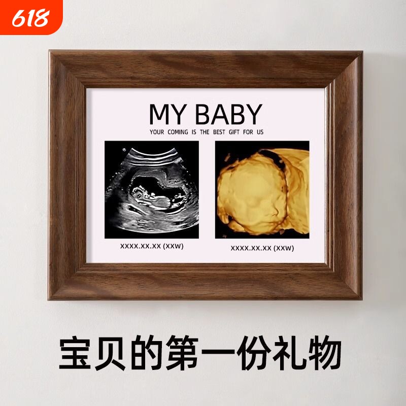 四维照片相框孕期胎儿nt B超彩超打印婴儿宝宝出生新生纪念照摆台
