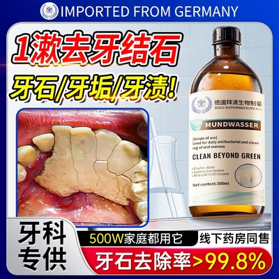 【爆款断货王】牙石溶解漱口水洗牙齿污垢牙垢黄牙渍清理神器
