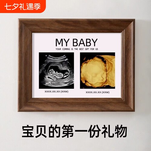 四维照片相框孕期胎儿ntB超彩超