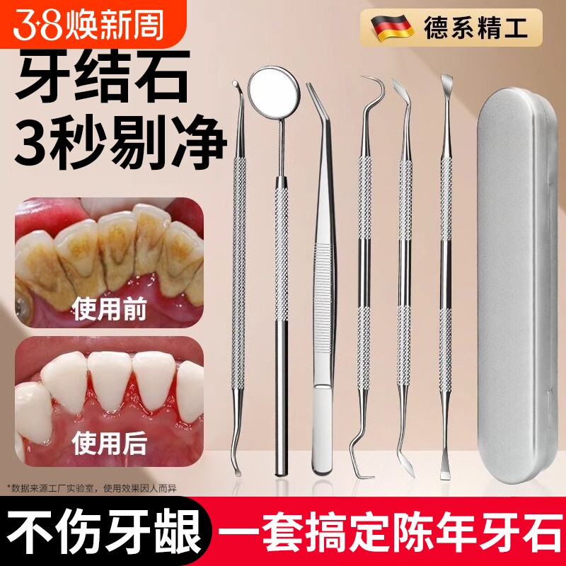 牙结石去除器牙齿清洁口腔镜子剔牙神器去污垢工具专用洁牙科家用