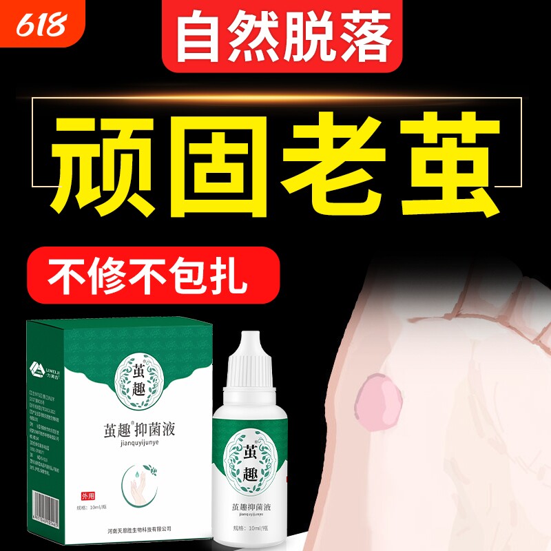 清茧灵脚底脚掌老茧去除软化剂手脚茧厚茧硬皮死皮脚钉脚垫非神器