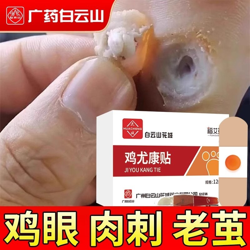 鸡眼贴膏去跖疣除老茧根官方正品旗舰店脚底脚后跟趾根肉刺医用