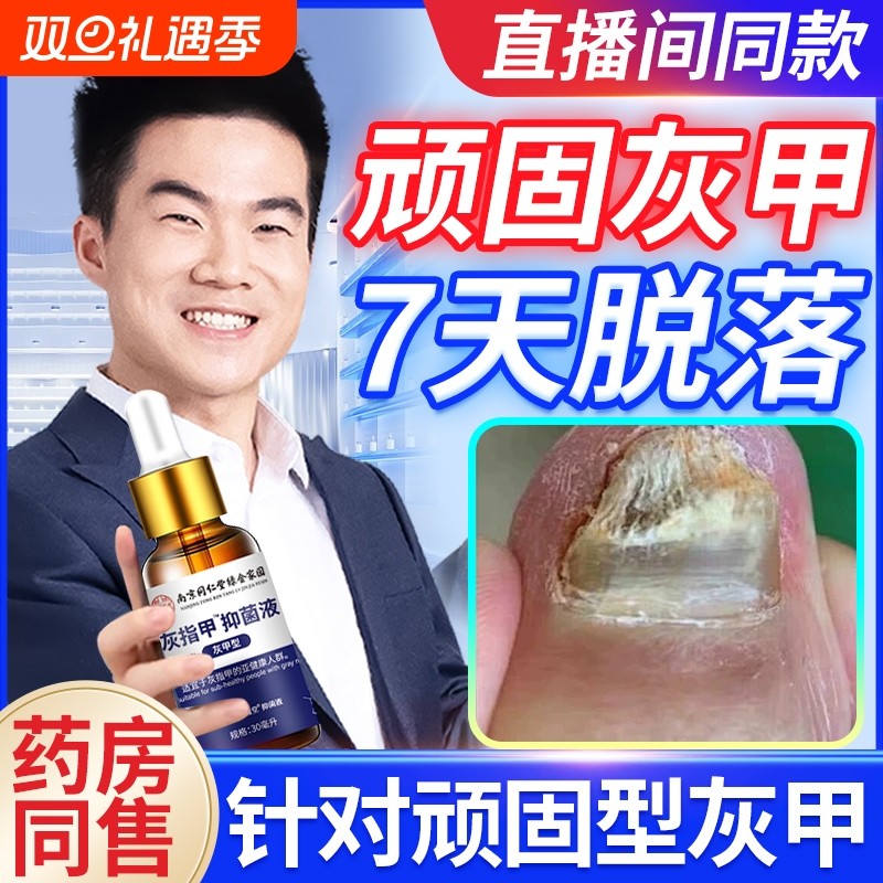 灰指甲脱甲脚趾型足部正品抑菌加快亮新甲生长修复凝胶药水增厚