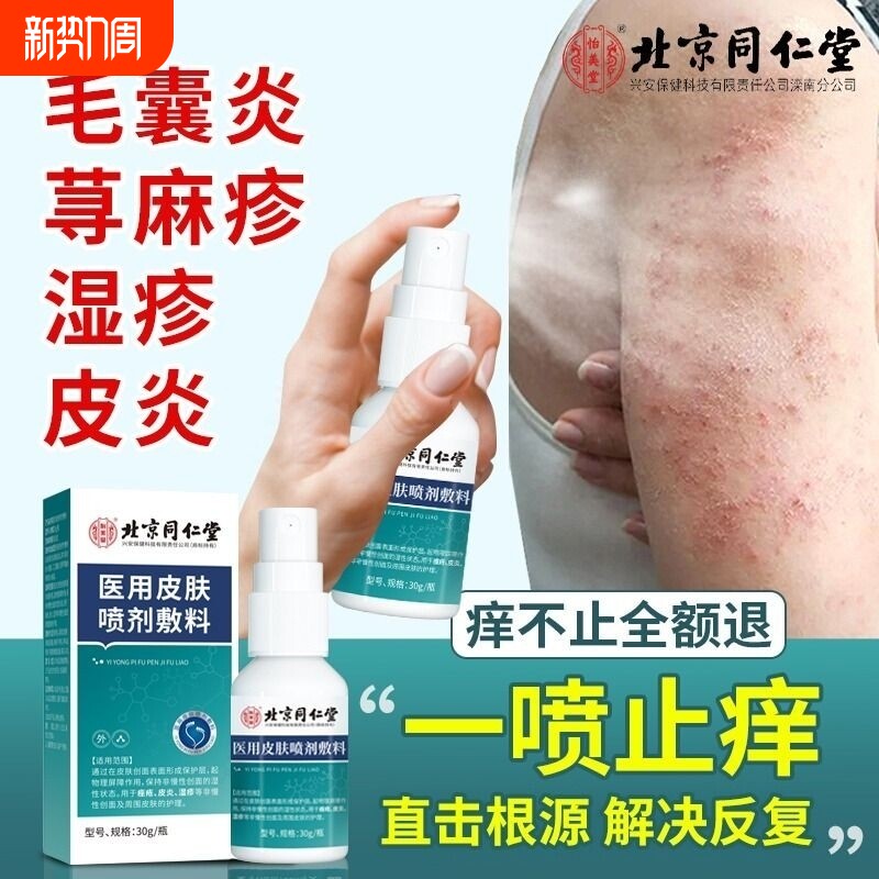 皮肤止痒膏去湿疹喷雾剂瘙痒专用皮炎湿疹膏膏外用汗泡疱疹毛囊炎