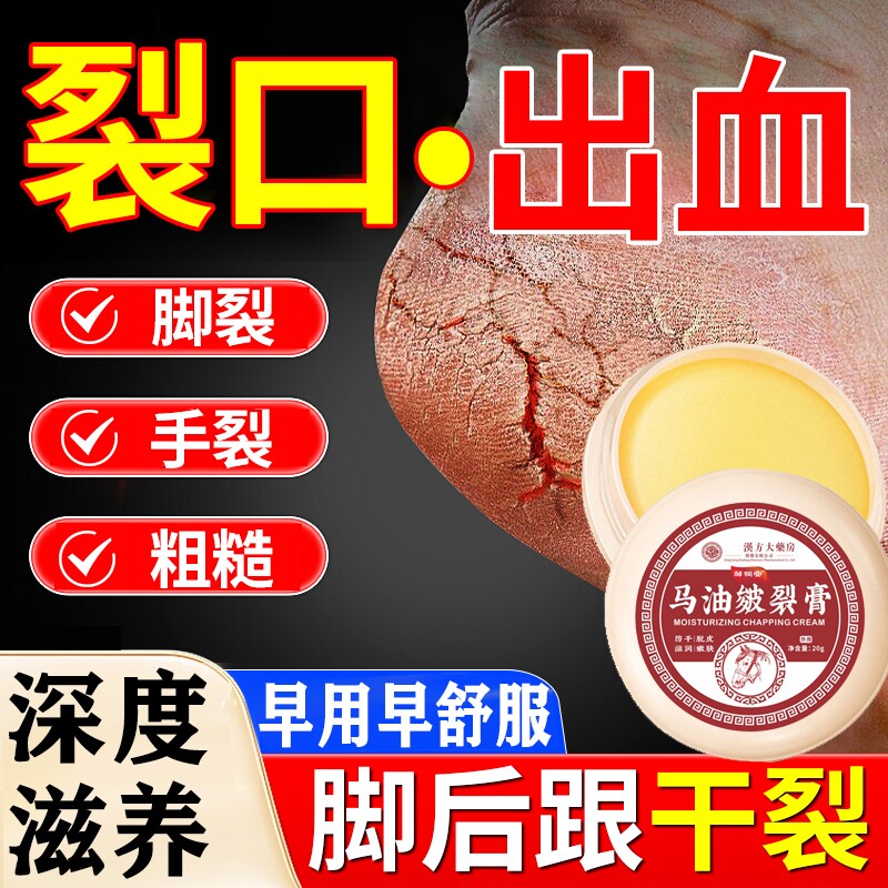 脚后跟干裂修复霜起硬皮足跟开裂手指头治裂口保湿修护皲裂复马油