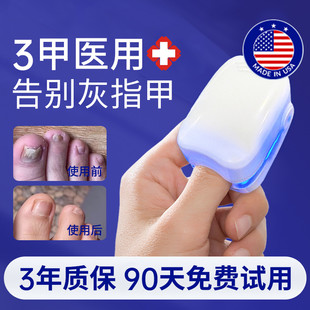 【药房正品】智能灰指甲光疗机真菌灯光疗仪灰指甲神器专用药家用