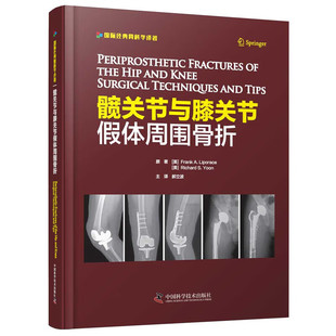 骨折类型 骨折处理要点 术前准备及术后处理 不同假体类型 术后康复方案指南 手术策略与固定技术 髋关节与膝关节假体周围骨折