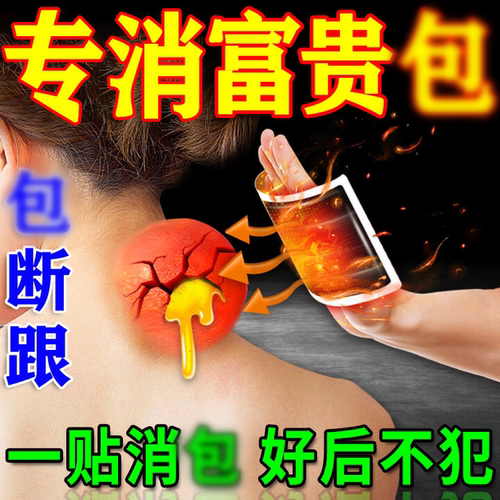 【香港大药房】已售100+富贵消除包针对脖子鼓包肩颈部驼