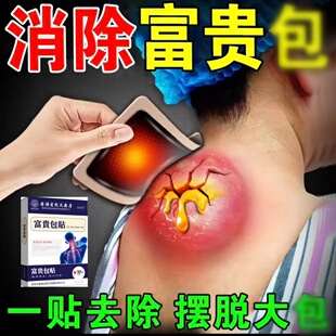 富贵消除包针对脖子鼓包肩椎疼痛颈部驼 已售100万