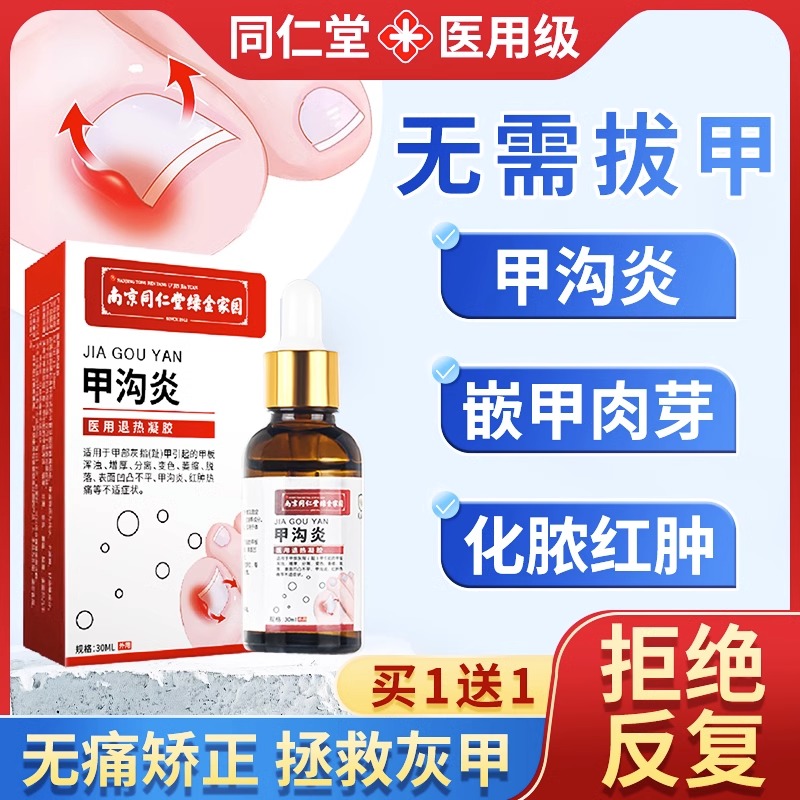 甲沟炎专非治疗用药息肉去除消肿软化剂嵌甲矫正器指甲去肉芽神器