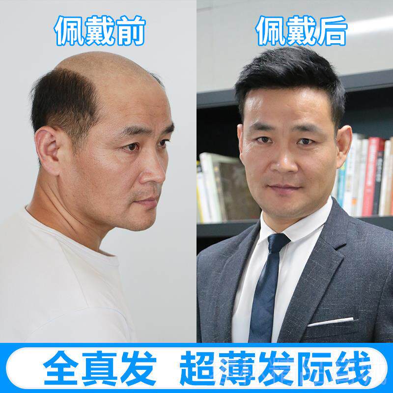 正品精递男士发假无痕织补发发片男短发帅气真人发丝秃顶头发顶补