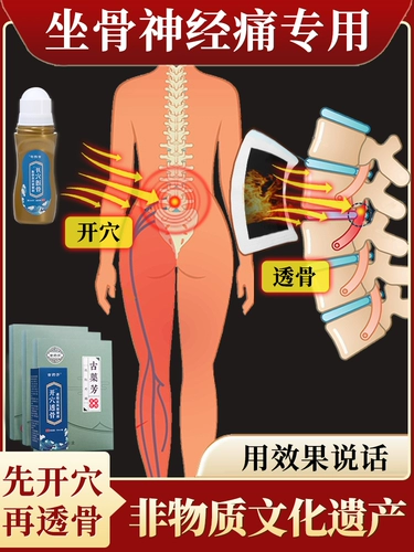 Магазин возвращается, чтобы пройти через тысячи лет в магазине ихетка, пастовая паста, боль в поясничной боли, боль в ногах, боль, боль, поясничный диск, выступающий с поясничным сжатием позвоночника кость руки