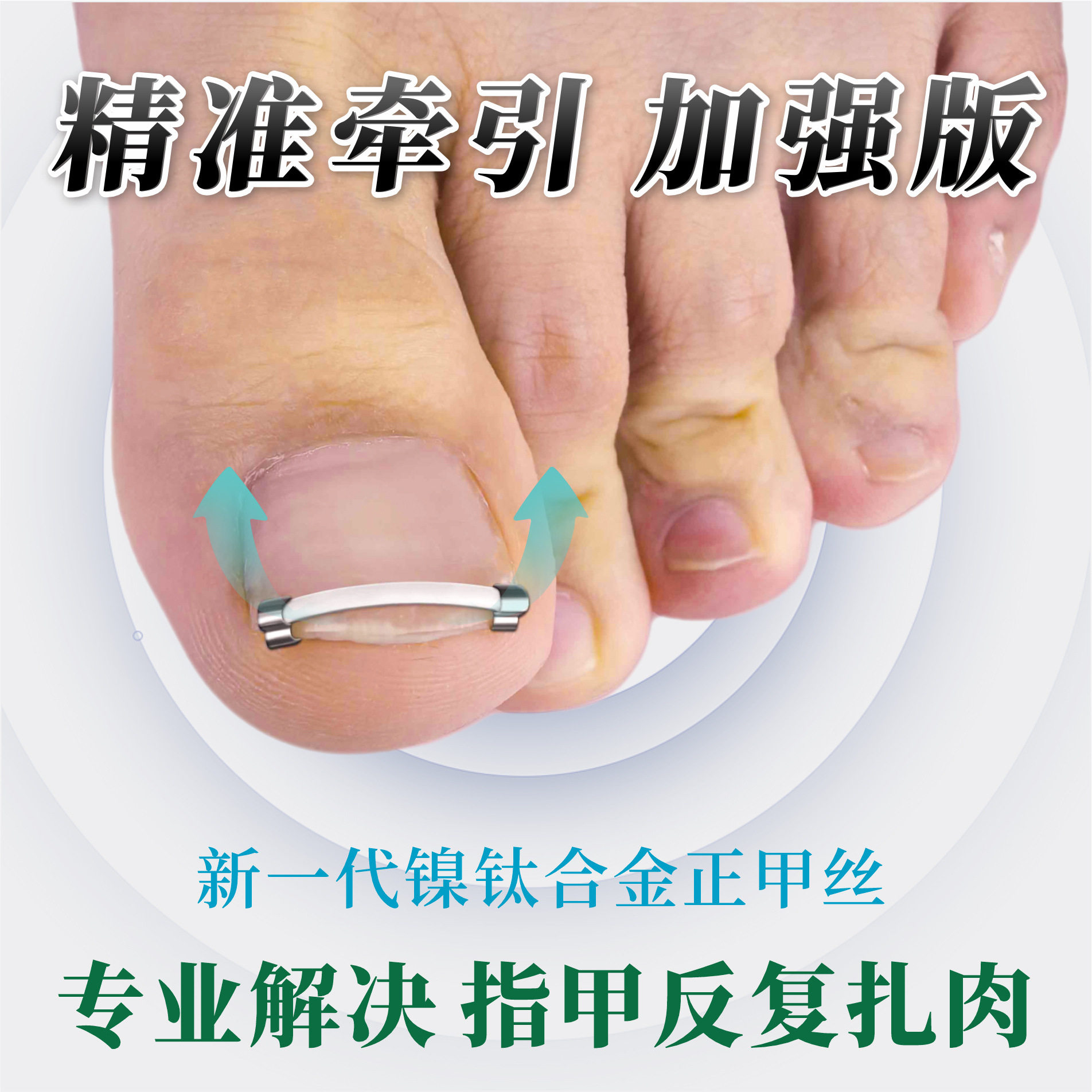 正甲贴镍钛合金卷甲拉拉正甲贴